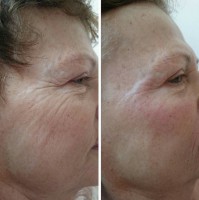 /album/fotogalerie/kh-pred-a-po-2-jpg/